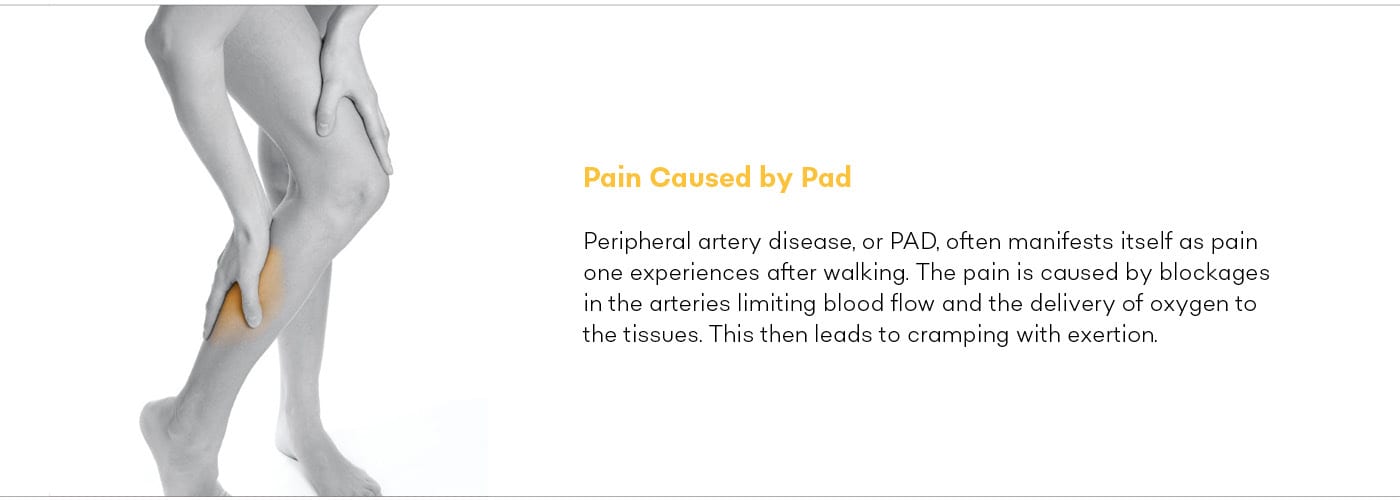 Ask the Doctor Peripheral artery disease quote.2