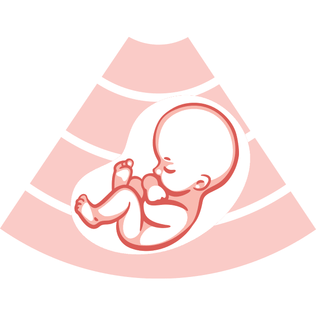 illustration of an ultrasound of a fetus