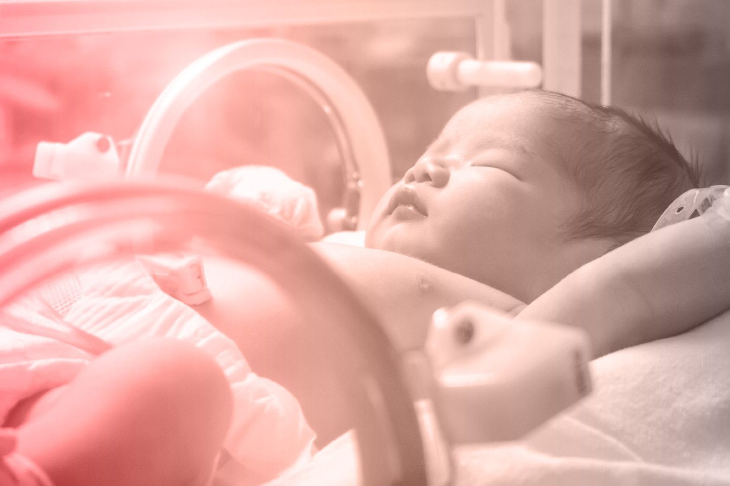 Premature baby in the NICU in an incubator