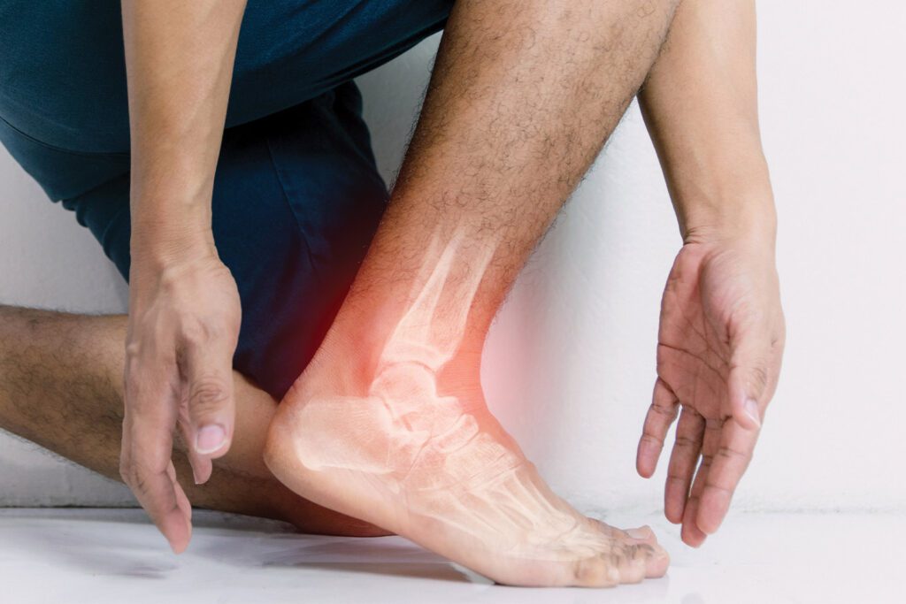 A man's ankle bone indicating an ankle replacement.