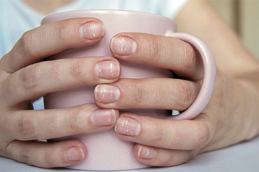 woman's hands holding a mug with spots on her nails